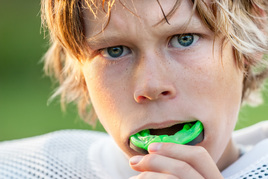 Sports Mouthguards are an important piece of sporting equipment, available at Clubb Dental
