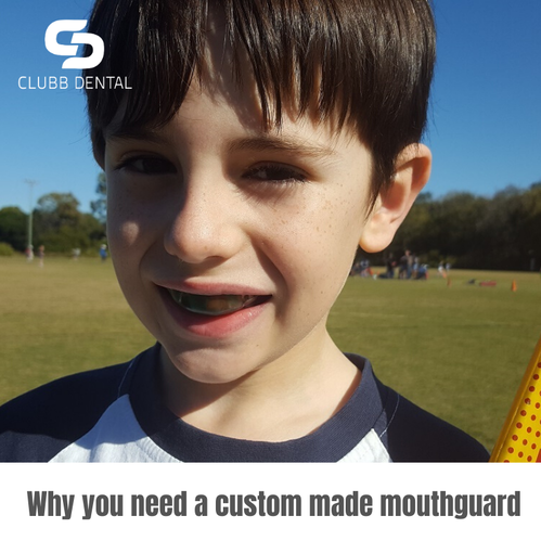 Why you need a custom made mouthguard Clubb Dental
