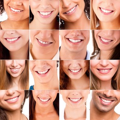 Cosmetic Dentistry available at Clubb Dental, Indooroopilly, Brisbane