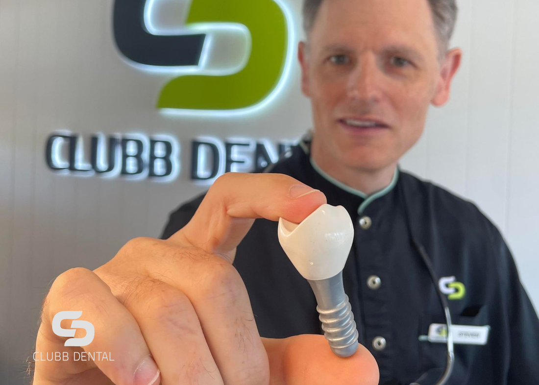 Clubb Dental Are dental implants the solution