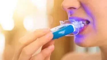 DIY teeth whitening kits are best avoided