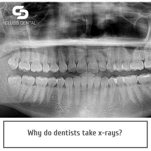 Coronavirus: Am I safe at the dentist? from Clubb Dental