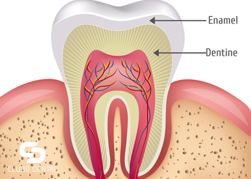 Enamel and Dentine structure of tooth causing sensitivity