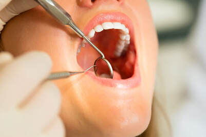 Dental Checkup at Clubb Dental