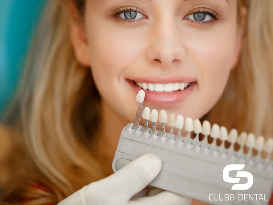 Zoom! Teeth Whitening at Clubb Dental