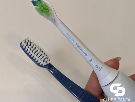 Clubb Dental Manual vs Electric toothbrush