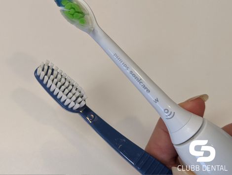 Clubb Dental Manual vs Electric toothbrush